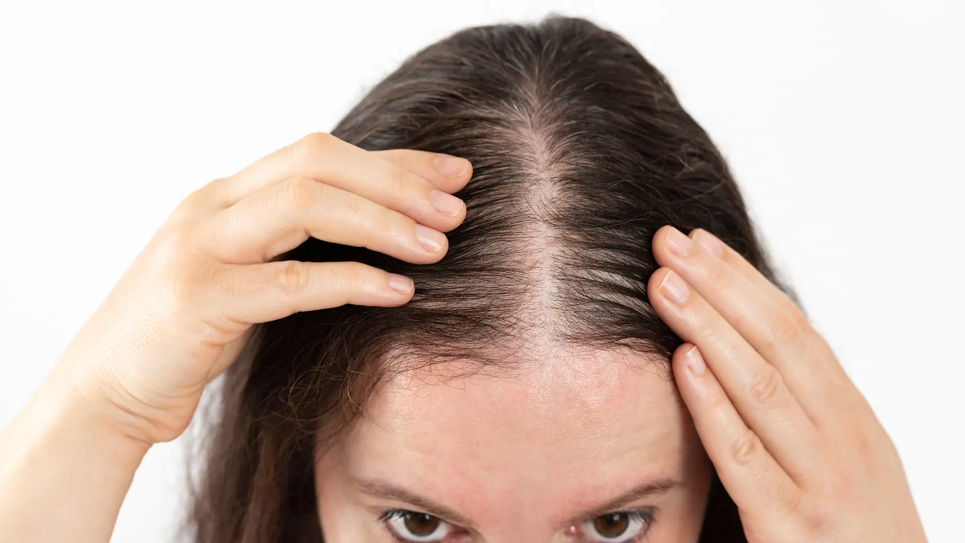 Hair Restoration (1)