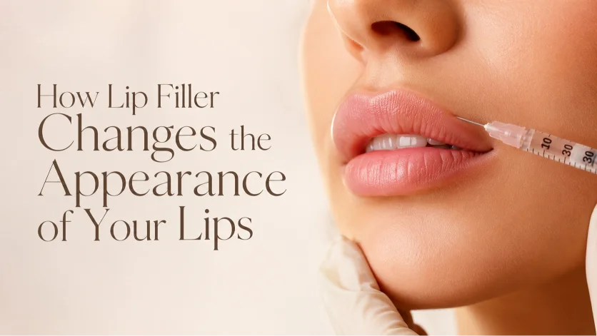 How Lip Filler Changes the Appearance of Your Lips