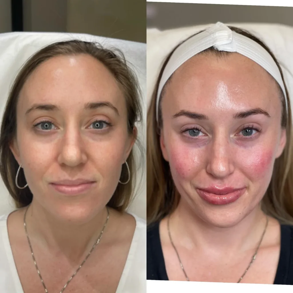 Before and After Photos From Glo-Med Clients
