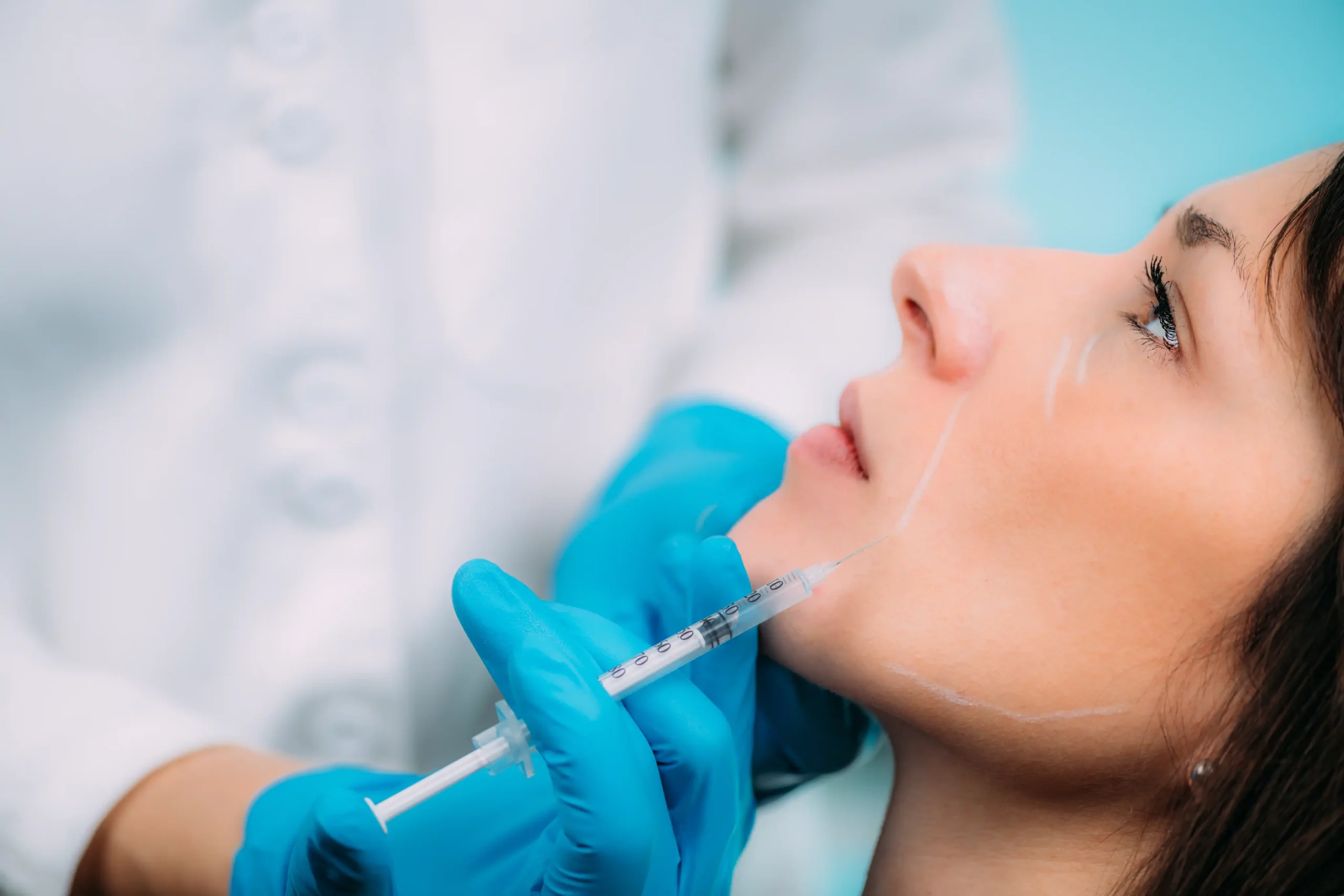 How Cheek Filler Supports the Rest of Your Face